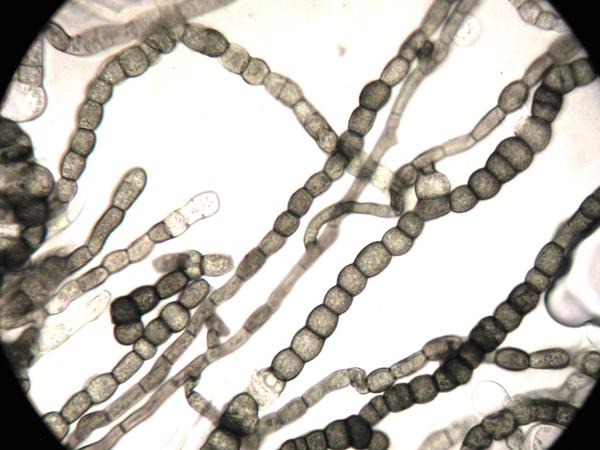 Coniosporium (c:stajichlab)