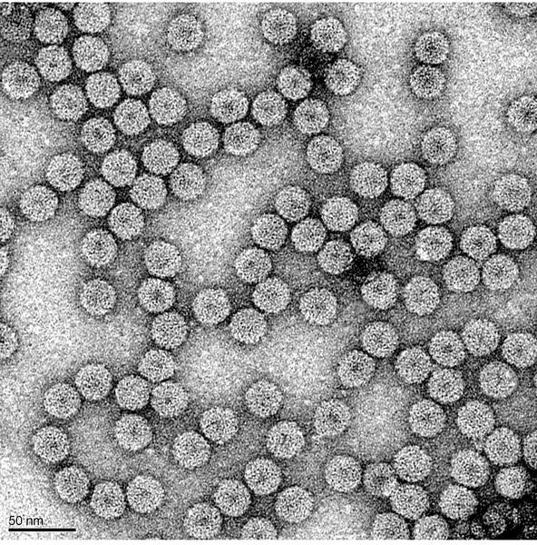 EM of BMV virions Rao Lab/UCR