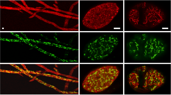 judelson fluorescence 